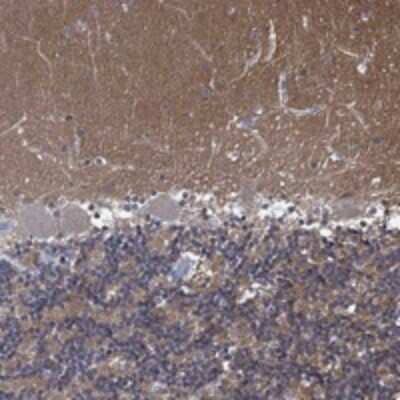 Immunohistochemistry-Paraffin ZNF671 Antibody