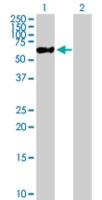 Western Blot: ZNF671 Antibody [H00079891-B01P] - Analysis of ZNF671 expression in transfected 293T cell line by ZNF671 polyclonal antibody.  Lane 1: ZNF671 transfected lysate(61.16 KDa). Lane 2: Non-transfected lysate.