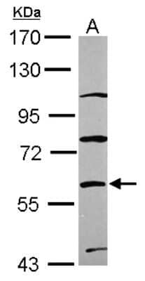 Western Blot ZNF671 Antibody - BSA Free