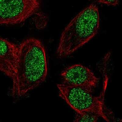 Immunocytochemistry/ Immunofluorescence ZNF672 Antibody - BSA Free