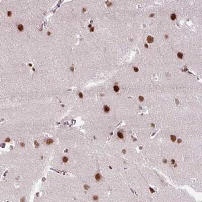Immunohistochemistry: ZNF672 Antibody [NBP2-47563] - Staining of human cerebral cortex shows strong nuclear positivity in neuronal cells.
