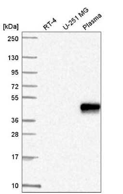 Western Blot ZNF672 Antibody - BSA Free