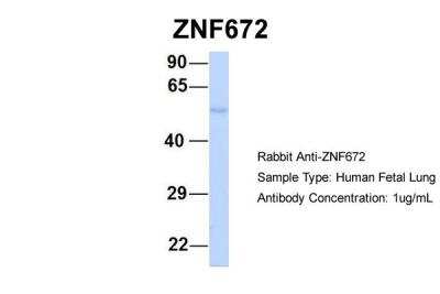 Western Blot ZNF672 Antibody - BSA Free