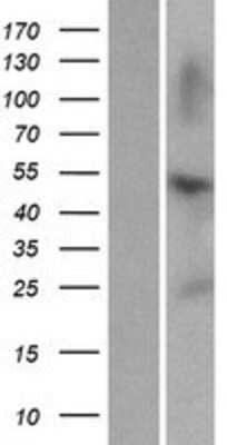 Western Blot ZNF672 Overexpression Lysate