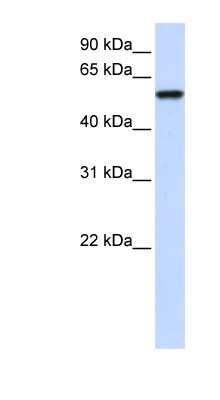 Western Blot: ZNF675 Antibody [NBP1-79700] - Human Brain lysate, concentration 0.2-1 ug/ml.