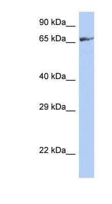 Western Blot ZNF676 Antibody