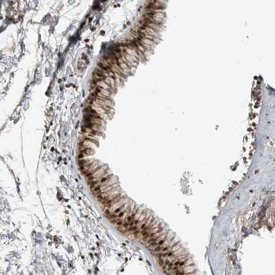Immunohistochemistry-Paraffin: ZNF677 Antibody [NBP1-82677] - Staining of human nasopharynx shows strong cytoplasmic and nuclear positivity in respiratory epithelial cells.