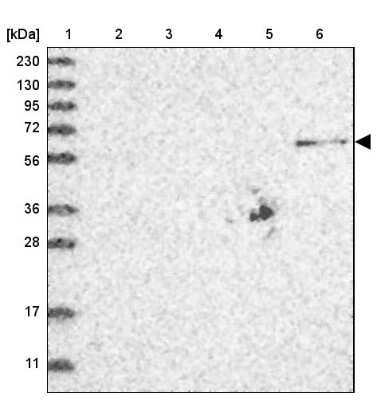 Western Blot: ZNF677 Antibody [NBP1-82677] - Lane 1: Marker  [kDa] 230, 130, 95, 72, 56, 36, 28, 17, 11.  Lane 2: Human cell line RT-4.  Lane 3: Human cell line U-251MG sp.  Lane 4: Human plasma (IgG/HSA depleted).  Lane 5: Human liver tissue.  Lane 6: Human tonsil tissue