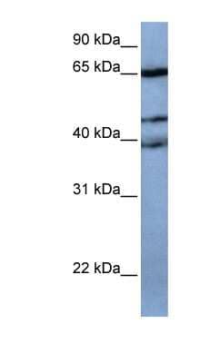 Western Blot: ZNF681 Antibody [NBP1-79463] - 721_B cell lysate, concentration 0.2-1 ug/ml.