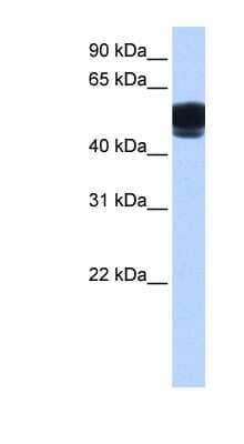 Western Blot: ZNF681 Antibody [NBP1-79464] - Human Brain lysate, concentration 0.2-1 ug/ml.