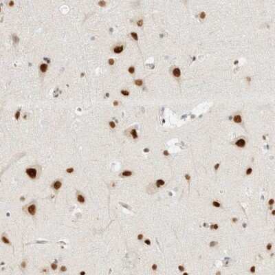 Immunohistochemistry-Paraffin ZNF683 Antibody - BSA Free