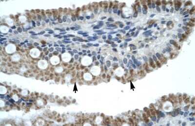 Immunohistochemistry-Paraffin ZNF683 Antibody - BSA Free