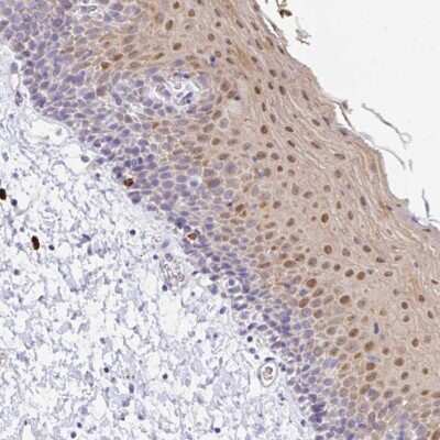 Immunohistochemistry-Paraffin: ZNF684 Antibody [NBP2-31751] - Staining of human oral mucosa shows moderate nuclear positivity in superficial layers of squamous epithelium.