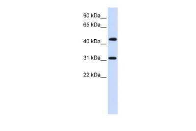 Western Blot: ZNF684 Antibody [NBP2-83890] - WB Suggested Anti-ZNF684 Antibody Titration: 0.2-1 ug/ml. ELISA Titer: 1:12500. Positive Control: Human brain