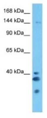 Western Blot: ZNF687 Antibody [NBP3-10509] - Western blot analysis of ZNF687 in Human A172 Whole Cell. Antibody dilution at 1ug/ml