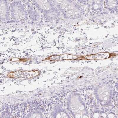 Immunohistochemistry-Paraffin: ZNF689 Antibody [NBP2-33752] - Staining of human small intestine shows strong cytoplasmic positivity in endothelial cells.