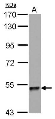 Western Blot: ZNF689 Antibody [NBP2-21040] - Sample (30 ug of whole cell lysate) A: HeLa 7. 5% SDS PAGE gel, diluted at 1:1000.
