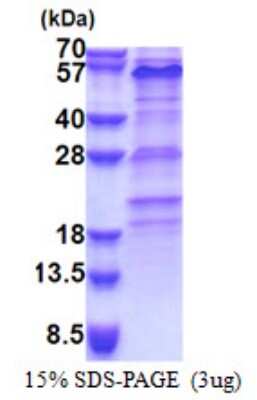 SDS-Page: ZNF689 Protein [NBP2-22958]