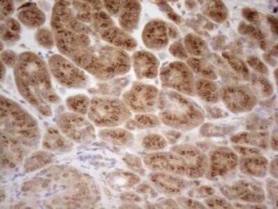 Immunohistochemistry ZNF69 Antibody (OTI3C3) - Azide and BSA Free
