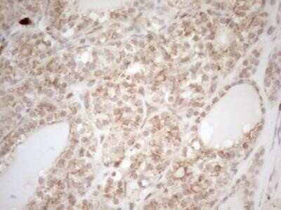 Immunohistochemistry ZNF69 Antibody (OTI3C3) - Azide and BSA Free