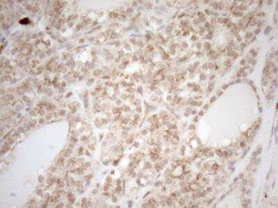 Immunohistochemistry-Paraffin ZNF69 Antibody (OTI3C3)
