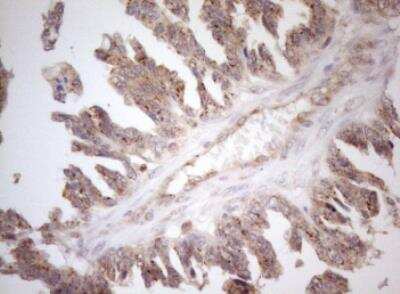 Immunohistochemistry-Paraffin ZNF69 Antibody (OTI3C3)