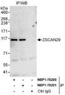 Immunoprecipitation: ZNF690 Antibody [NBP1-78200] - Whole cell lysate (1 mg for IP, 20% of IP loaded) from HeLa cells. Affinity purified rabbit anti-ZSCAN29 antibody used for IP at 6 mcg/mg lysate.  ZSCAN29 was also immunoprecipitated by rabbit anti-ZSCAN29 antibody NBP1-78201, which recognizes a downstream epitope