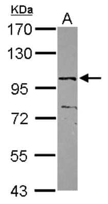 Western Blot: ZNF690 Antibody [NBP2-21042] - Sample (30 ug of whole cell lysate) A: MCF-7 7. 5% SDS PAGE gel, diluted at 1:500.