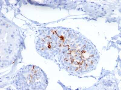 Immunohistochemistry-Paraffin ZNF690 Antibody (ZSCAN29/2610)