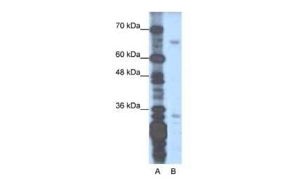 Western Blot: ZNF691 Antibody [NBP2-83895] - WB Suggested Anti-ZNF691 Antibody Titration: 1.25ug/ml. Positive Control: Transfected 293T