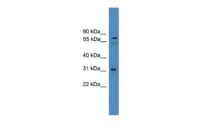 Western Blot: ZNF691 Antibody [NBP2-83896] - WB Suggested Anti-ZNF691 Antibody Titration: 0.2-1 ug/ml. ELISA Titer: 1:312500. Positive Control: HT1080 cell lysate
