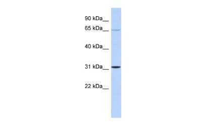 Western Blot: ZNF691 Antibody [NBP2-83897] - WB Suggested Anti-ZNF691 Antibody Titration: 0.2-1 ug/ml. ELISA Titer: 1:312500. Positive Control: Human brain