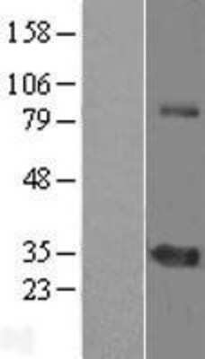 Western Blot ZNF691 Overexpression Lysate