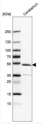 Western Blot ZNF692 Antibody - BSA Free