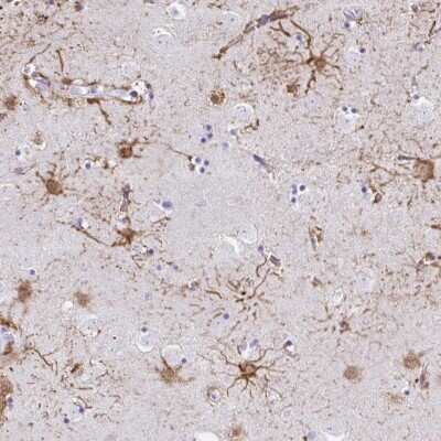 Immunohistochemistry ZNF699 Antibody - BSA Free