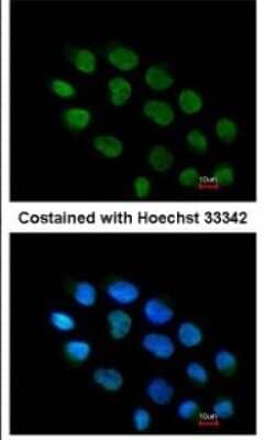 Immunocytochemistry/Immunofluorescence: ZNF7 Antibody [NBP1-32386] - Paraformaldehyde-fixed A431, using antibody at 1:200 dilution.