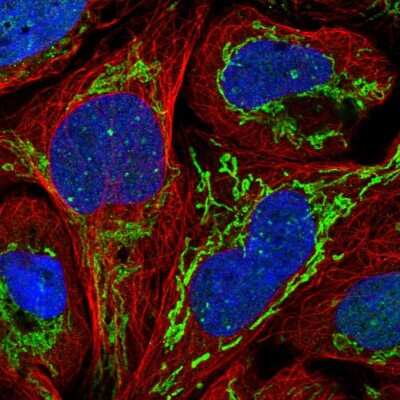 Immunocytochemistry/Immunofluorescence: ZNF7 Antibody [NBP2-56106] - Staining of human cell line U-2 OS shows localization to nuclear bodies & mitochondria.