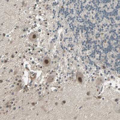Immunohistochemistry-Paraffin ZNF701 Antibody - BSA Free
