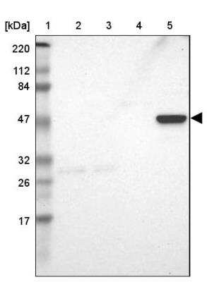 Western Blot ZNF701 Antibody - BSA Free
