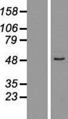 Western Blot ZNF701 Overexpression Lysate
