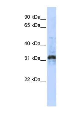Western Blot ZNF705D Antibody - BSA Free