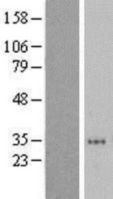 Western Blot ZNF705D Overexpression Lysate