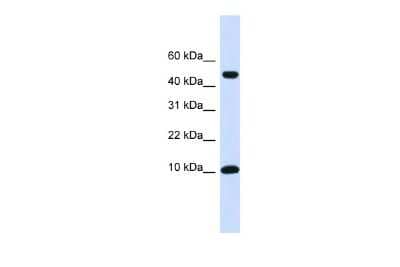 Western Blot: ZNF706 Antibody [NBP3-09189] - Western blot analysis using NBP3-09189 on Transfected 293T  as a positive control. Antibody Titration: 0.2-1 ug/ml