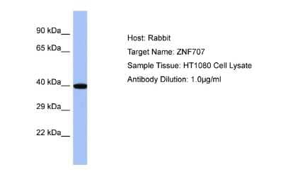 Western Blot: ZNF707 Antibody [NBP2-86551] - Host: Rabbit. Target Name: ZNF707. Sample Type: HT1080 Whole cell lysates. Antibody Dilution: 1.0ug/ml