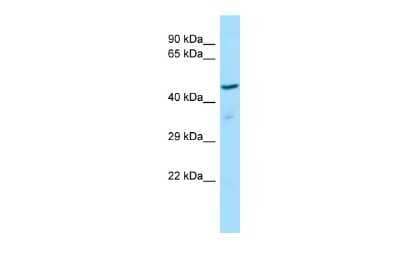 Western Blot: ZNF707 Antibody [NBP3-10517] - Western blot analysis of ZNF707 in Rat Thymus lysates. Antibody dilution at 1.0ug/ml