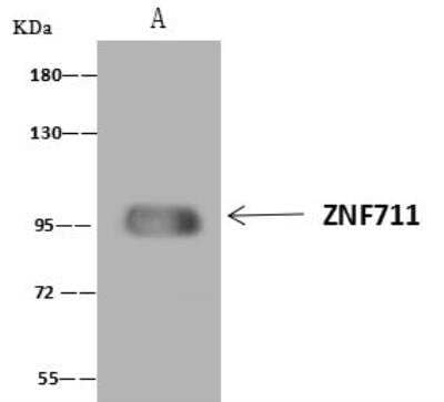 Immunoprecipitation: ZNF711 Antibody [NBP3-12580] - Lane A:0.5 mg OVCAR-3 Whole Cell Lysate4 uL anti-ZNF711 rabbit polyclonal antibody and 60 ug of Immunomagnetic beads Protein A/G.Primary antibody:Anti-ZNF711 rabbit polyclonal antibody,at 1:100 dilution Secondary antibody:Goat Anti-Rabbit IgG (H+L)/HRP at 1/10000 dilutionDeveloped using the ECL technique.Performed under reducing conditions.Predicted band size: 87 kDaObserved band size :95 kDa