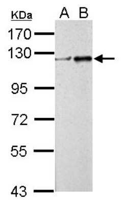 Western Blot: ZNF711 Antibody [NBP2-21045] - Sample (30 ug of whole cell lysate) A: Non-transfected 293T lysates B: ZNF711 transfected 293T lysates 7. 5% SDS PAGE gel, diluted at 1:5000.