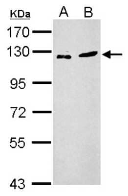 Western Blot: ZNF711 Antibody [NBP2-21045] - Sample (30 ug of whole cell lysate) A: PC-3 B: SK-N-SH 7. 5% SDS PAGE gel, diluted at 1:2000.