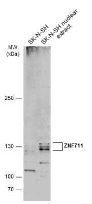 Western Blot: ZNF711 Antibody [NBP2-21046] - SK-N-SH whole cell and nuclear extracts (30 ug) were separated by 5% SDS-PAGE, and the membrane was blotted with ZNF711 antibody diluted at 1:500. The HRP-conjugated anti-rabbit IgG antibody was used to detect the primary antibody.