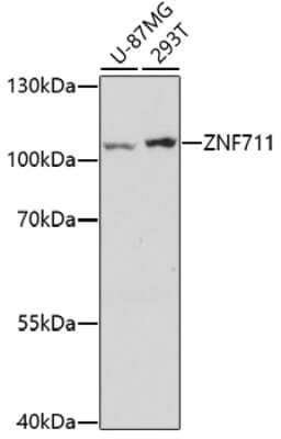 Western Blot: ZNF711 Antibody [NBP2-94844] - Analysis of extracts of various cell lines, using ZNF711 . Exposure time: 3min.